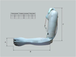 Custom Cosmetic Arm Prosthesis