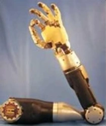 Electromechanical Shoulder Prosthesis with Contact Control System PR8-MPU.1