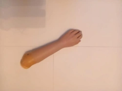 Cosmetic Forearm Prosthesis for All Ages and Genders
