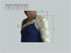 Custom-Made Wrist, Elbow, and Shoulder Joint Apparatus