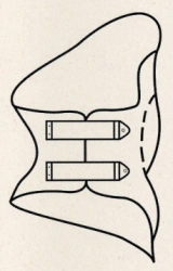 Functional Correction Corset for Lumbar Spine KR4-24