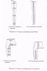 Knee Joint Brace TН4-02 for All Age Groups