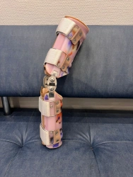 Knee Joint Stabilizing Device with Thermoplastic Shells