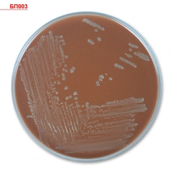 Chocolate Agar Medium for Cultivating Fastidious Microorganisms