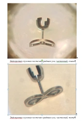 Middle Ear Sound Conduction Prostheses, ESC-"KONMET", Partial Model TU 32.50.22-030-11458417-2021