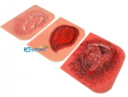 Burn Simulation Set of 3 Models NMR-3