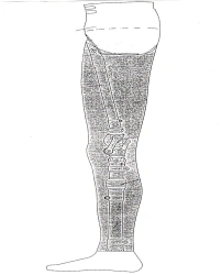 Modular Hip Prosthesis