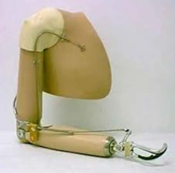 Functional-Cosmetic Prosthesis for Above-Elbow Amputation
