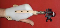 Functional Hand Prosthesis for Partial and Complete Amputation