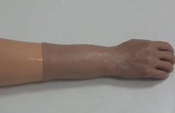 Cosmetic Forearm Prosthesis for Functional Use