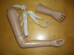 Active Shoulder Prosthesis (Tensile) - Right/Left Version