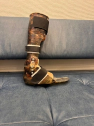 Ankle Joint Rehabilitation Device