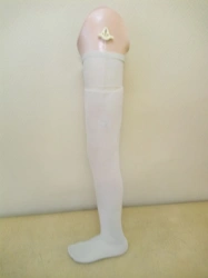 Modular Hip Prosthesis for Congenital Underdevelopment