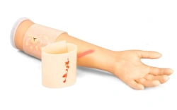 Phantom Hand with Forearm for Burn and Wound Treatment, ZIK-18
