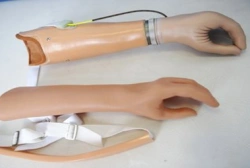 Active Forearm Prosthesis (Tensile Type)