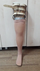 Non-modular Hip Prosthesis for Congenital Underdevelopment PN6-N.1