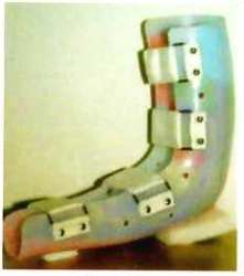 Custom Elbow Joint Tutor Left/Right Model for Immobilization