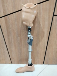 Modular Hip Prosthesis for Underdevelopment Cases