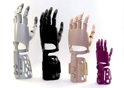 Active Hand Prosthesis Custom-Made