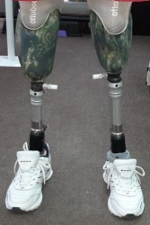 Modular Lower Leg Prosthesis for Individuals with Limb Development Issues