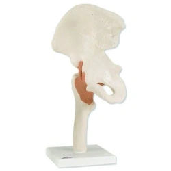 Life-size Hip Joint Model for Studying Anatomy, SK2110