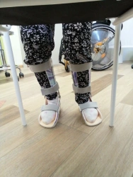 Orthopedic Ankle Joint Support Device for Stabilization