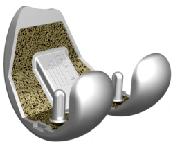 Left Femoral Components for Knee Replacement Sizes 1-5