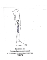 Modular Hip Prosthesis with External Power Source PN6-78