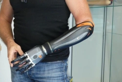 Microprocessor-Controlled Forearm Prosthesis