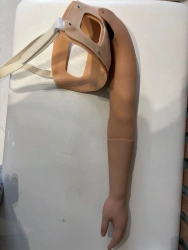 Cosmetic Prosthesis for Shoulder Amputation